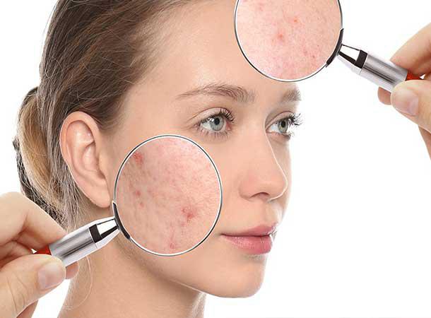 Cosmetic Skin Problems