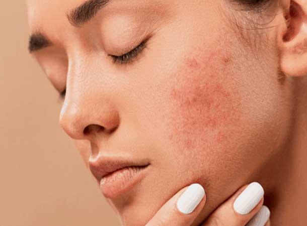 All Dermatologic Problems